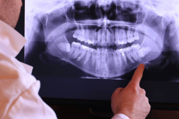 Best Emergency Tooth Extraction in Snyder, OK
