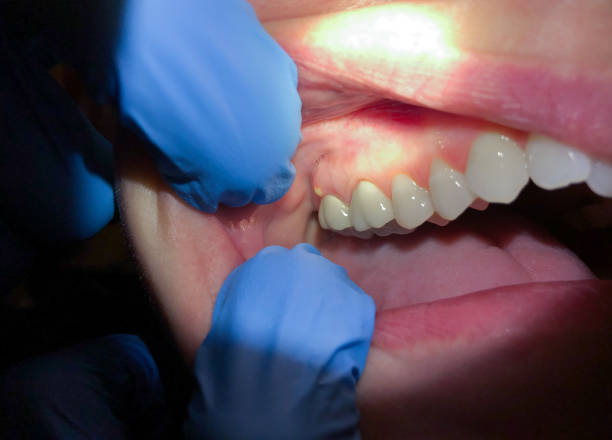 Best Emergency Treatment for Toothache in Snyder, OK